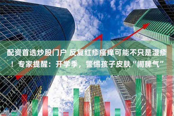 配资首选炒股门户 反复红疹瘙痒可能不只是湿疹！专家提醒：开学季，警惕孩子皮肤“闹脾气”